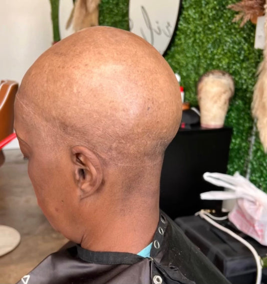 Hair Loss Masterclass